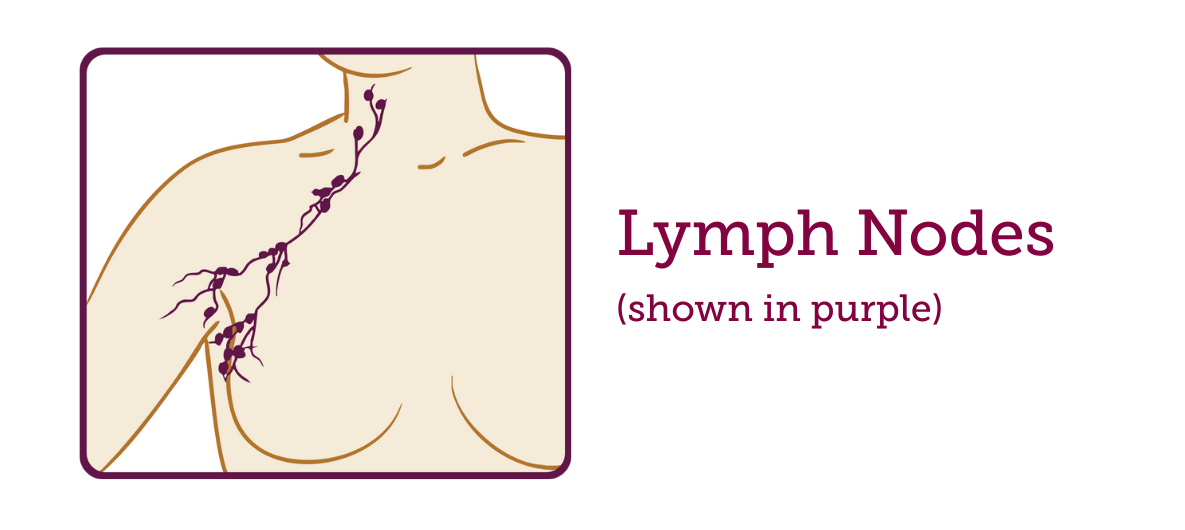 New Study Suggests Some Breast Cancer Patients May Safely Avoid Lymph Node Radiation After a Complete Response to Chemotherapy 2 lymph nodes