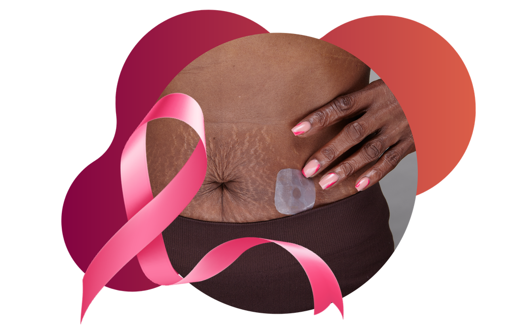 Hormone Therapy and Breast Cancer Risk: What Can Our Genetics Tell Us? 3 10 26 Header image